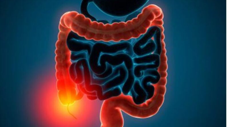 Denuncian dificultades de pacientes con enfermedades inflamatorias intestinales para acceder a tratamientos