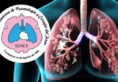 Especialistas abogan por mejorar disponibilidad de inhaladores para pacientes  con asma