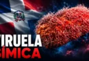 Autoridades confirman dos casos de viruela símica en San Cristóbal