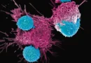 Investigadores identifican un cambio celular que podría ayudar a frenar la leucemia mieloide aguda