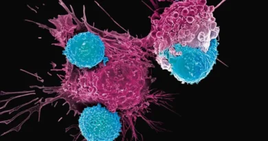 Investigadores identifican un cambio celular que podría ayudar a frenar la leucemia mieloide aguda