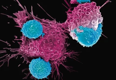 Investigadores identifican un cambio celular que podría ayudar a frenar la leucemia mieloide aguda
